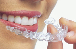 Ortodonzia Invisibile: Invisalign