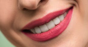 Faccette dentali estetiche