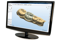 Tecnologia Cad Cam